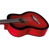 CS-10 Red Burst